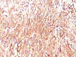 DOG1/TMEM16A Antibody (DOG-1.1), Novus Biologicals 0.2mg; Unlabeled:Antibodies,